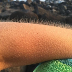 Intuition - goose bumps